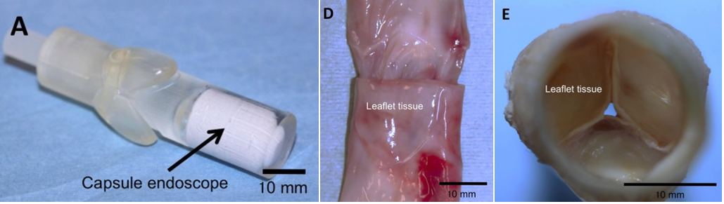 biovalve