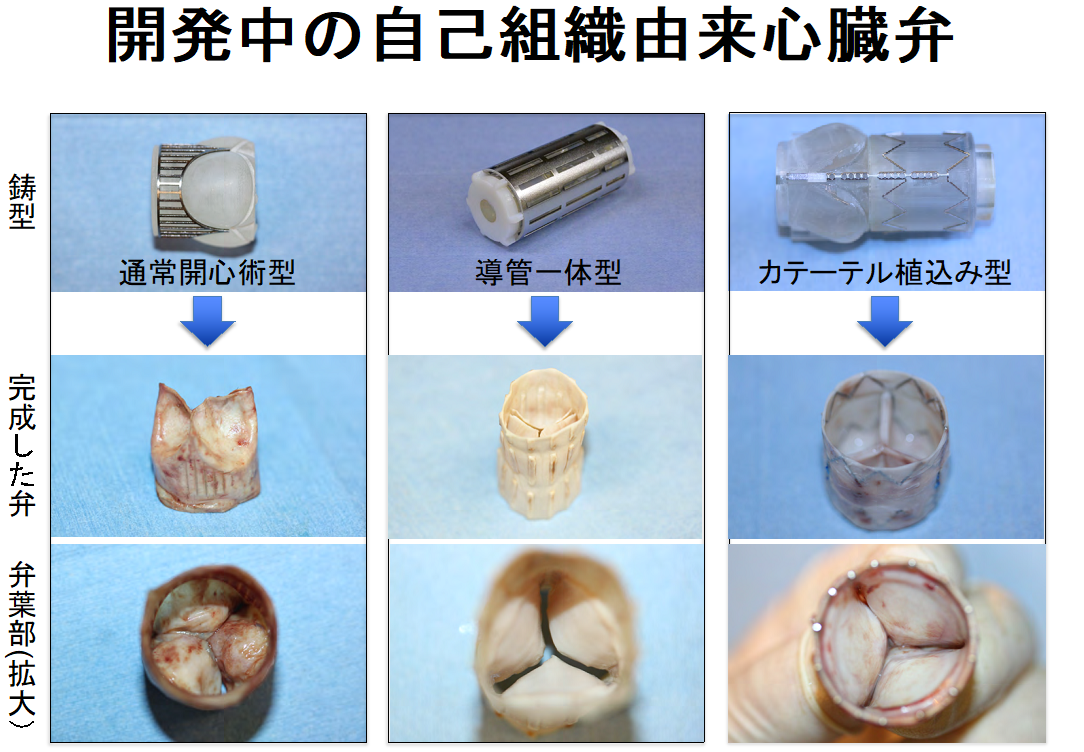 biovalve3