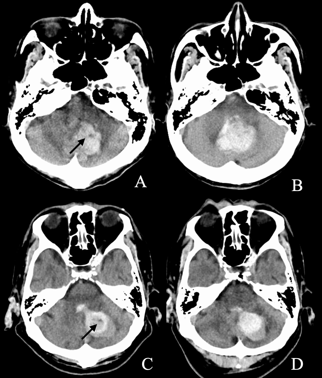 ~臨床・画像・病理を通して理解できる!~呼吸器疾患:Clinical-Radiological-Pathologicalアプローチ Amazon.co.jp: ~臨床・画像・病理を通して理解できる!~呼吸器