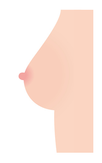 乳腺イラスト