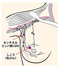 リンパ節図