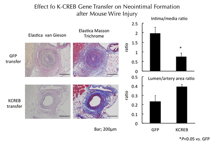 Effect fo K-CREB Gene Transfer on Neointimal Formation after Mouse Wire Injury