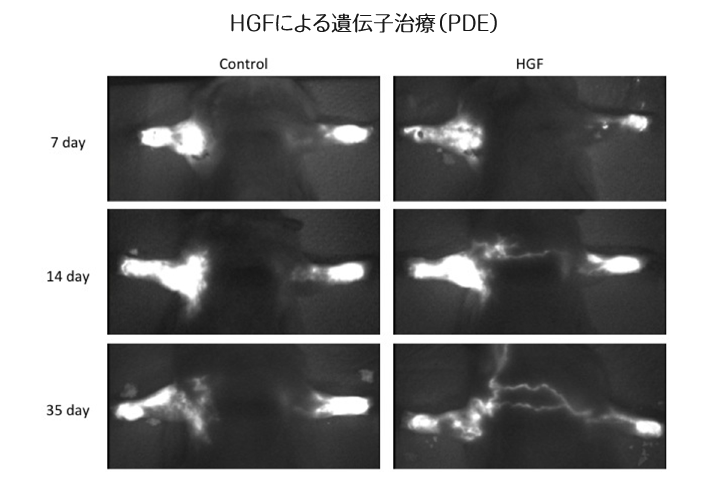 HGFによる遺伝子治療(PDE)