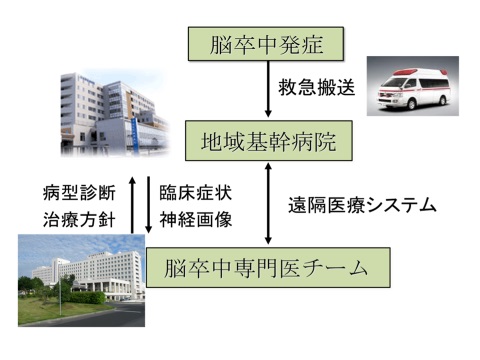 Telestroke（脳卒中遠隔医療）の概念図